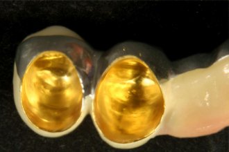 Mit eingalvanisierter Goldschicht