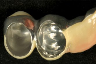 Zu lockere Teleskope